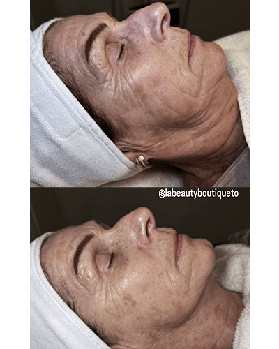 skincare near me toronto north york midtown la beauty boutique