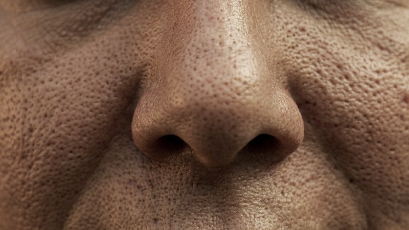 Skin texture pores treatment toronto