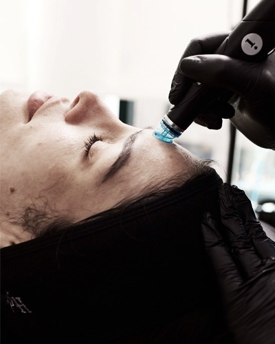 Hydrafacial Toronto La Beauty Boutique