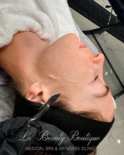 la beauty boutique dermaplaning north york toronto